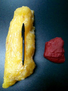 pound of fat vs. pound of muscle fat vs. muscle